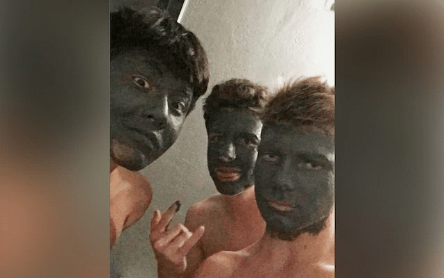 Teens kicked out of school for ‘blackface’ photo receive $1 million after proving it was acne mask 1 image 44
